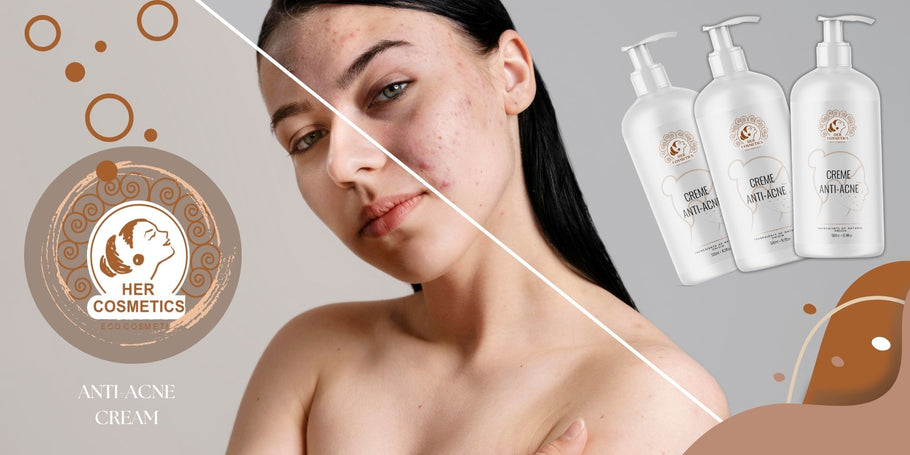 How can acne be treated to eliminate breakouts?